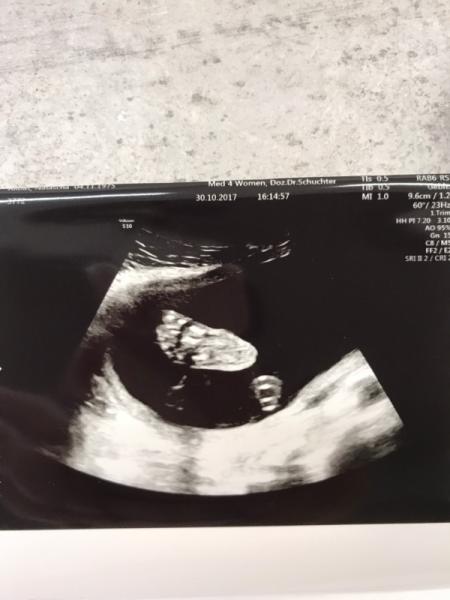 Bild zu Alles schick beim Organscreening - Forum für März - Mamis