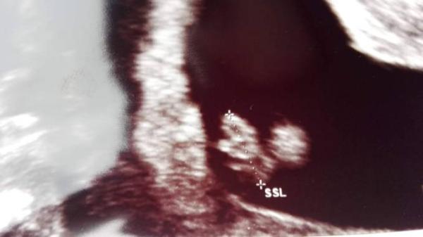 Bild zu Auch dabei und Fruchthöhle - Forum für März - Mamis