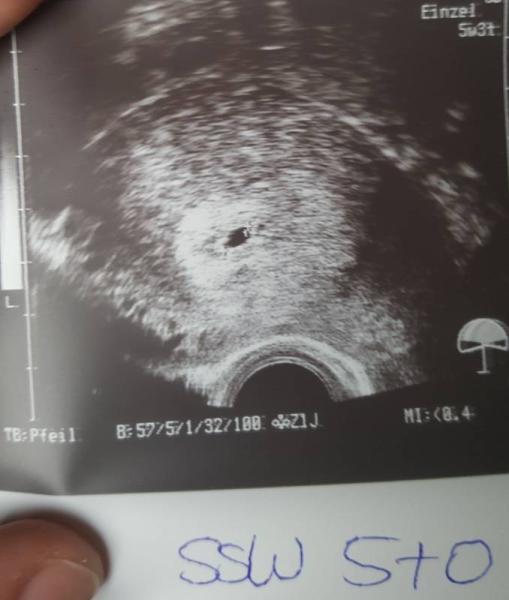 Bild zu Termin in der KIWU - Forum für März - Mamis