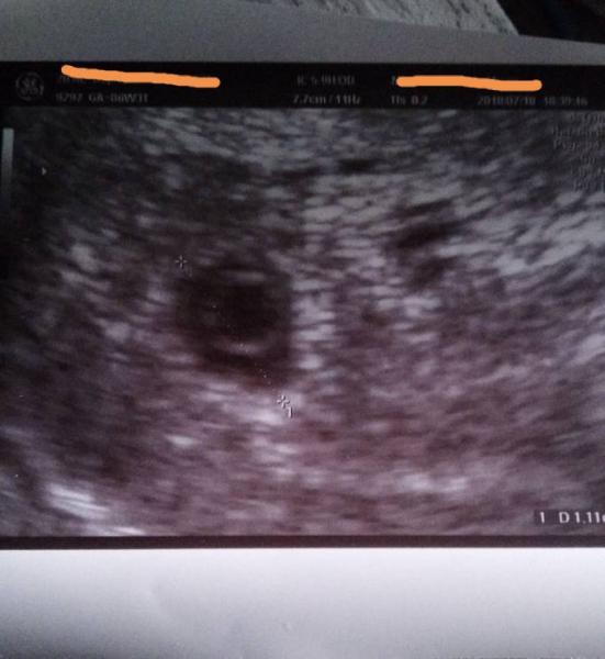 Bild zu Ich nochmal - Forum für März - Mamis