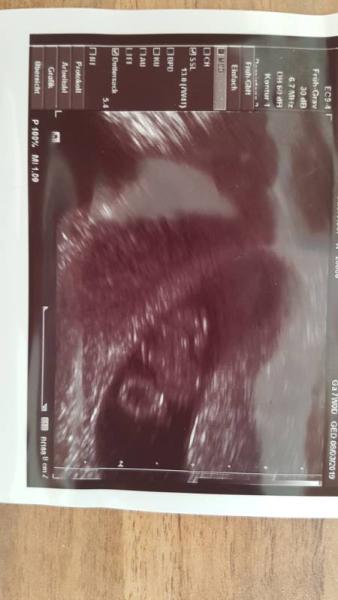 Bild zu 7SSW - Forum für März - Mamis