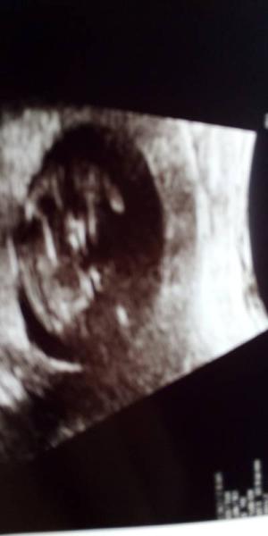 Bild zu Zurück vom gyn.... - Forum für März - Mamis