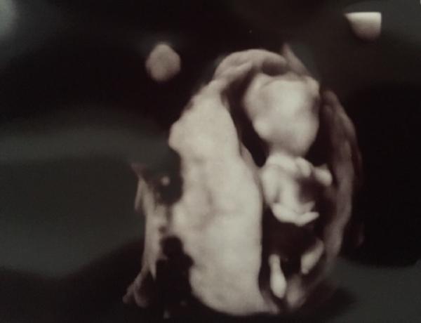 Bild zu Heute großer Ultraschall gehabt  - Forum für März - Mamis