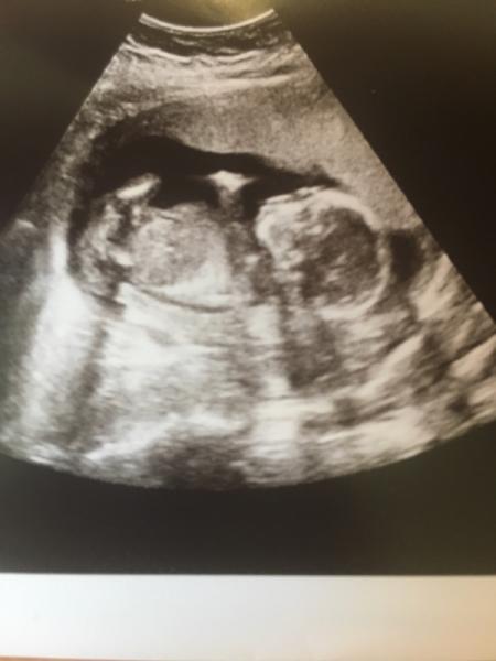 Bild zu Termin gehabt+ recht eindeutiges Outing đ - Forum fĂŒr MĂ€rz - Mamis