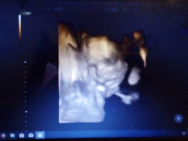 Bild zu Großer organ us - Forum für März - Mamis
