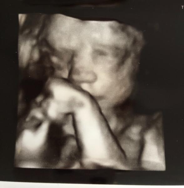 Bild zu Ultraschall und Foto - Forum für März - Mamis