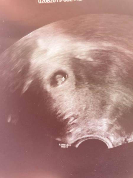 Bild zu War beim Fa, wegen meiner Vorgeschichte  - Forum für März - Mamis
