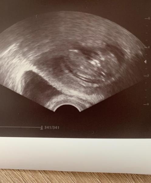 Bild zu Termin beim FA 😍 - Forum für März - Mamis