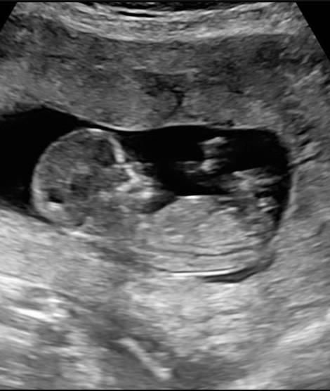 Bild zu Wirklich Mädchen? - Forum für März - Mamis