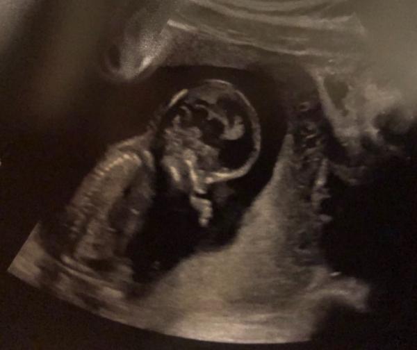 Bild zu Heute war Baby Kino! < 3 - Forum für März - Mamis