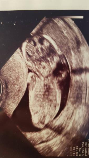 Bild zu Mädchen oder Junge? - Forum für März - Mamis