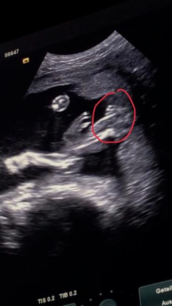 Bild zu Junge oder Mädchen? - Forum für März - Mamis