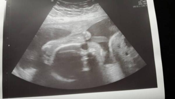 Bild zu Zurück vom Zuckertest - Forum für März - Mamis