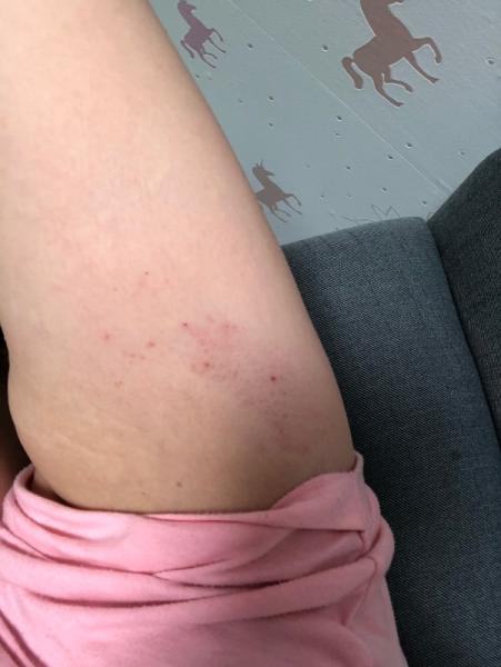 Bild zu PUPP oder HELLP ? - Forum für März - Mamis