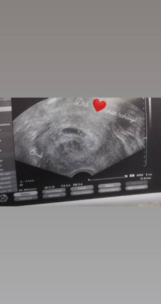 Bild zu ...aus der Kinderwunschklinik entlassen😍 - Forum für März - Mamis