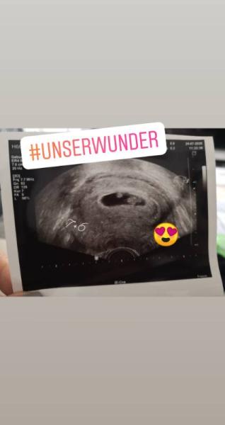 Bild zu Soooo verliebt😍 - Forum für März - Mamis