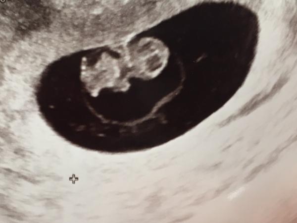 Bild zu 8+3 Termin - Forum für März - Mamis