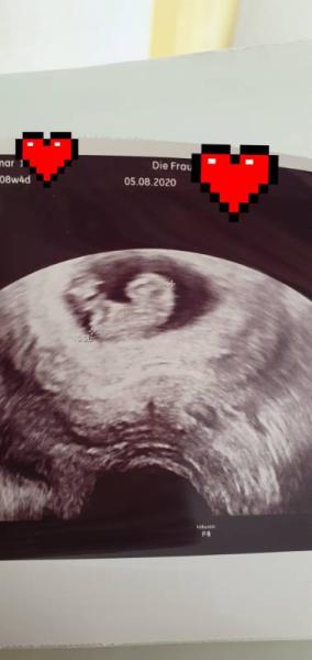 Bild zu Ultraschall 8+4 - Forum für März - Mamis