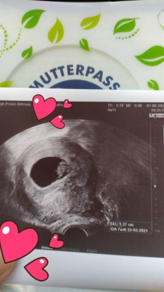Bild zu Termin bei 8+1 - Forum für März - Mamis
