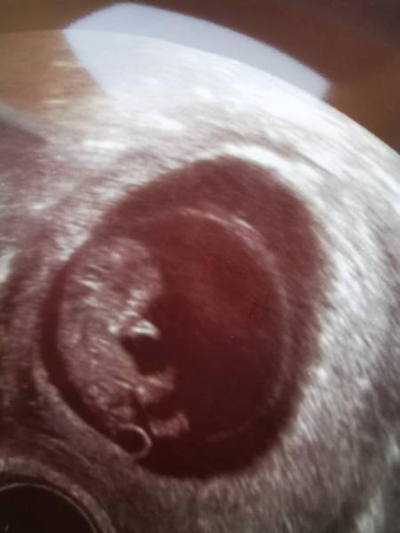 Bild zu So, ihr dürft mich steinigen 🙈 - Forum für März - Mamis