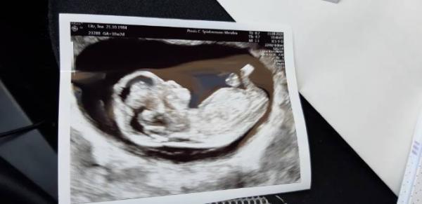 Bild zu Ich bin auch zurück vom FA - Forum für März - Mamis
