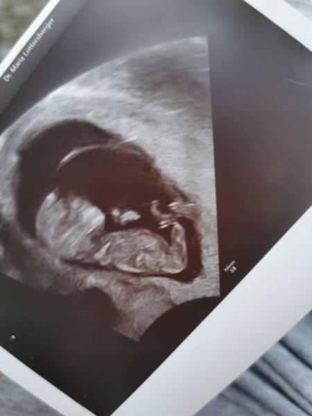 Bild zu FA Termin - Forum für März - Mamis