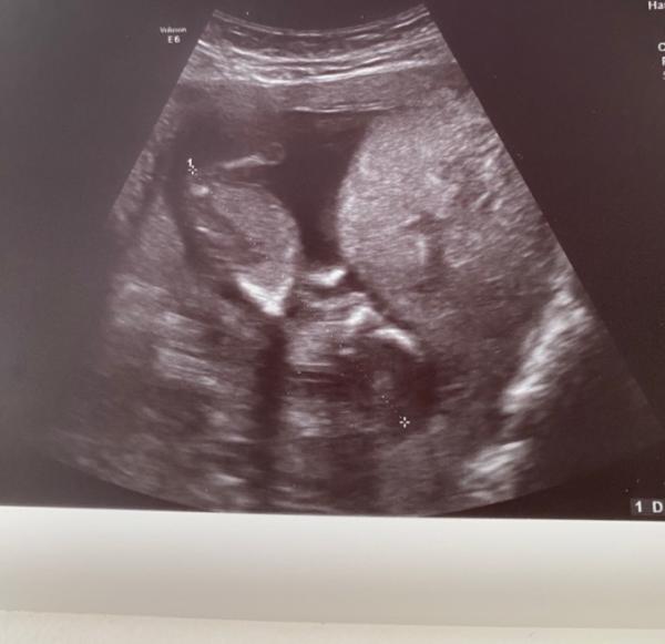 Bild zu Termin gehabt ♥️ - Forum für März - Mamis