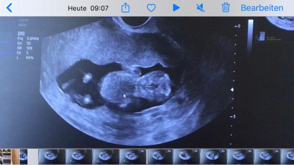 Bild zu Auch Termin gehabt - Forum für März - Mamis