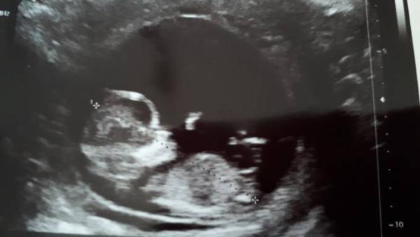 Bild zu Zurück vom Frauenarzt - Forum für März - Mamis