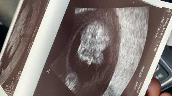 Bild zu Harmonytest überraschung - Forum für März - Mamis