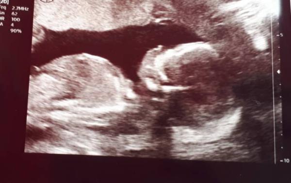 Bild zu Und noch ein ... - Forum für März - Mamis