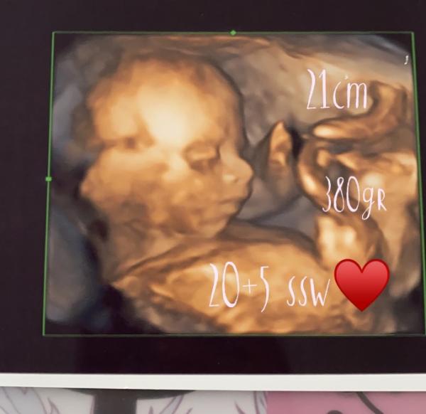 Bild zu Großer US ♥️ - Forum für März - Mamis