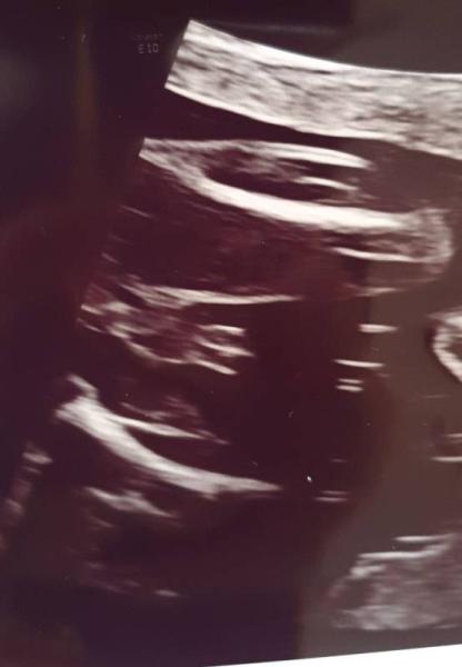Bild zu Geschlecht des Babys - Forum für März - Mamis