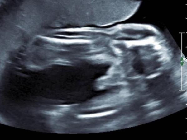 Bild zu Geschlecht eindeutig? - Forum für März - Mamis