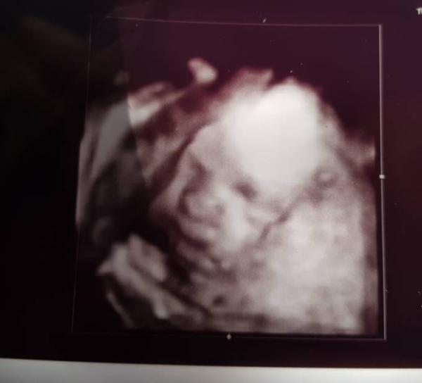 Bild zu Heute 3D Ultraschall gehabt. đ„° - Forum fĂŒr MĂ€rz - Mamis