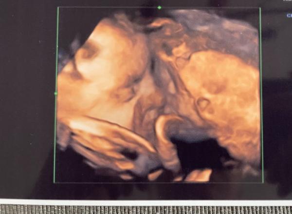 Bild zu 3. großer US ♥️ - Forum für März - Mamis