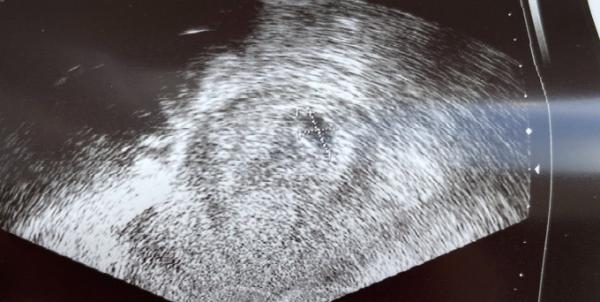 Bild zu Heute Ultraschall - Forum für März - Mamis