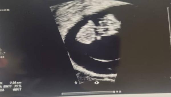 Bild zu FA Termin heute/ Ultraschallbild - Forum für März - Mamis