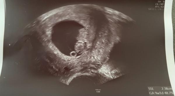 Bild zu Heute Ultraschall weiterhin positiv - Forum für März - Mamis
