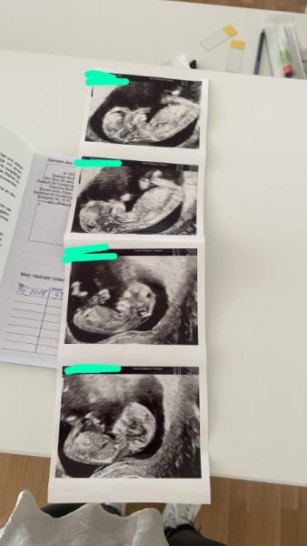 Bild zu 2 termin 🥰 - Forum für März - Mamis
