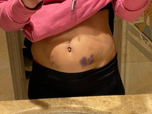 Bild zu Heparin - Forum für März - Mamis