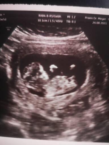 Bild zu Update, US Bild, Preana Test und Nub Theorie - Forum für März - Mamis