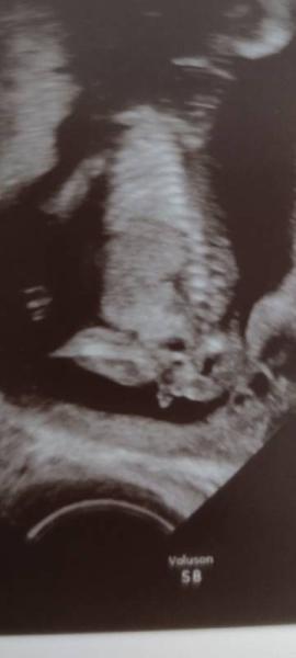 Bild zu Mädchen oder Junge? - Forum für März - Mamis