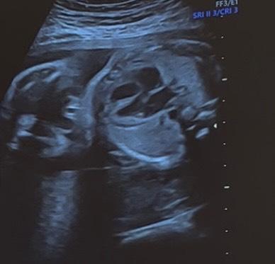 Bild zu Geschlecht raten - Forum für März - Mamis