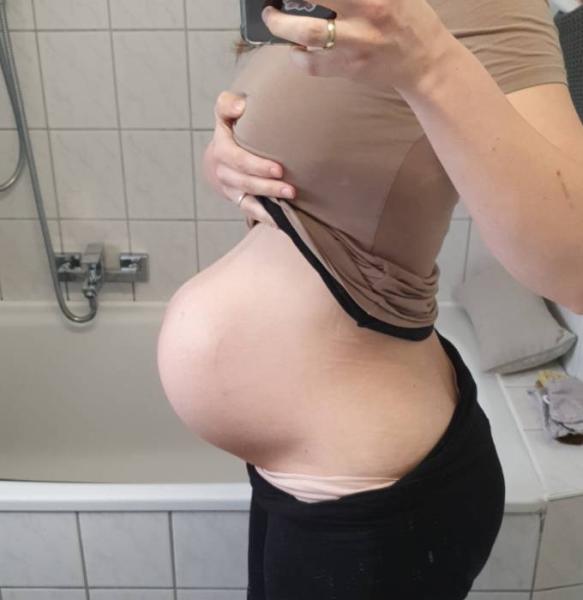 Bild zu Verformter Bauch - Forum für März - Mamis