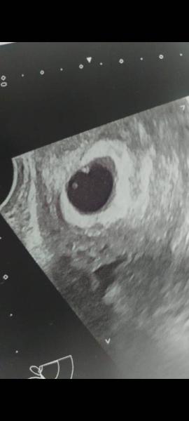 Bild zu Gerade aus dem Krankenhaus ..... - Forum für März - Mamis