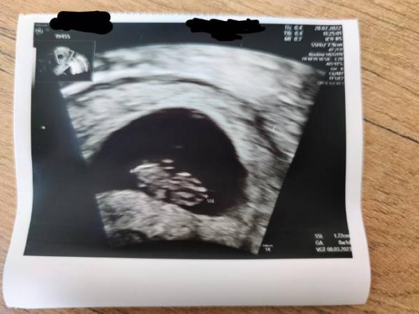 Bild zu Ich fühl mich hat nicht gut - Forum für März - Mamis