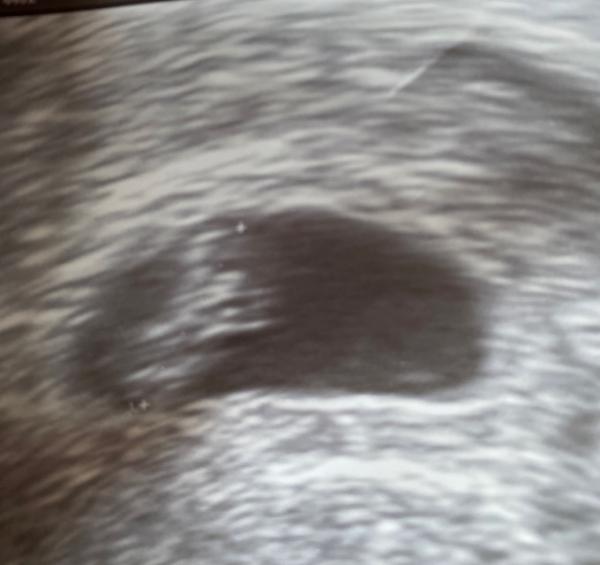 Bild zu Herzchen schlägt 🥰🥰 - Forum für März - Mamis