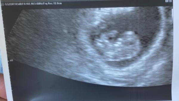 Bild zu sooooo happy - Forum für März - Mamis