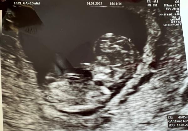 Bild zu Ein Märzbaby - Forum für März - Mamis